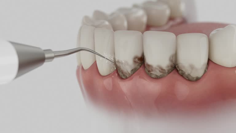 Reliable Dental contractor in Marion, MS by Smile Center Dentistry